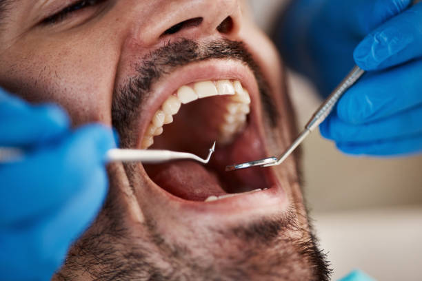 Best Emergency Broken Tooth Repair in Atoka, TN